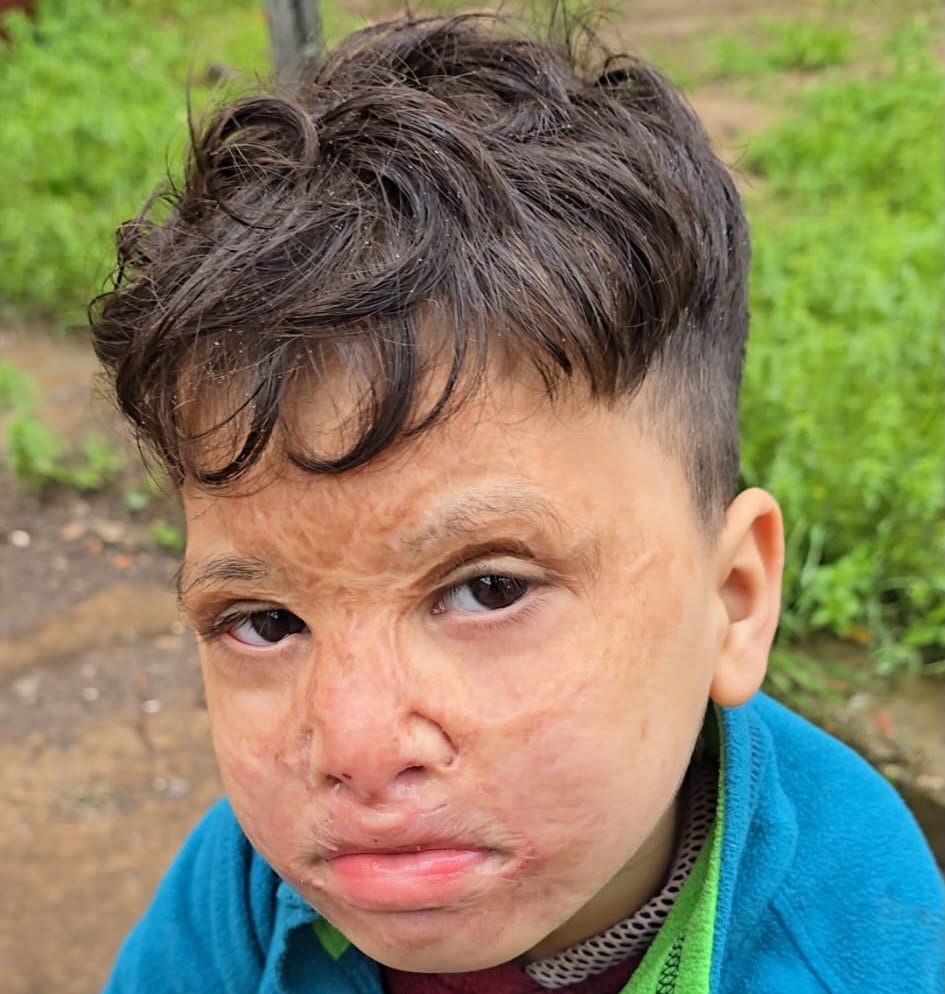 Stand With Little Ahmed
