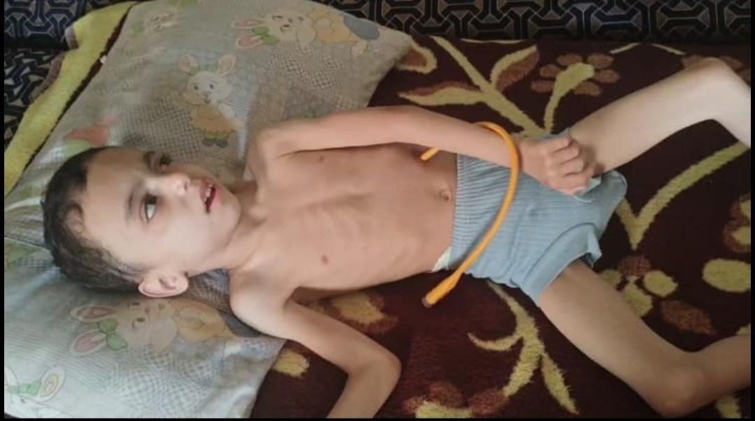 Hussein’s Struggle for a Life Without Barriers