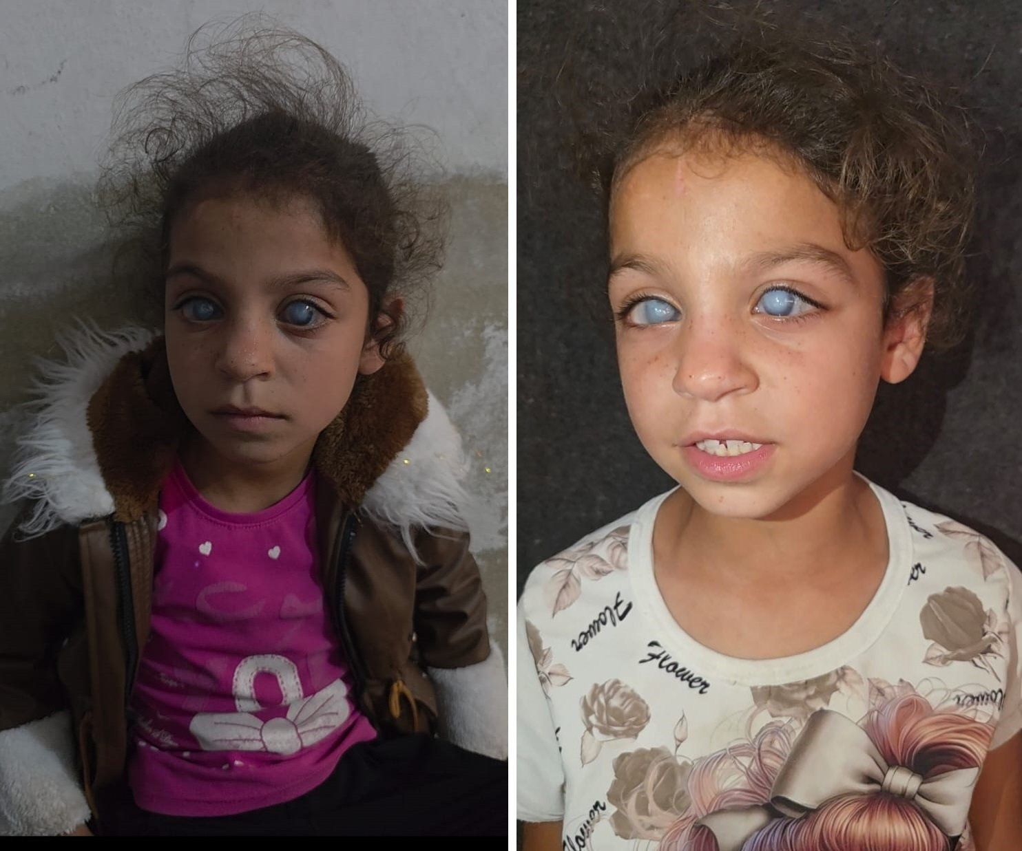 Help Sundus Get the Eye Care She Needs