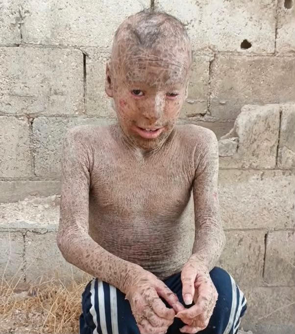 Stand With Little Mahmoud Al-Ali
