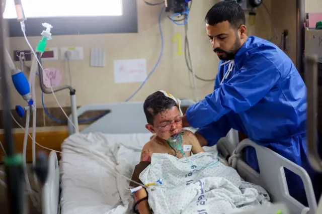 💔 أنقذوا أملي في الشفاء | نداء إنساني من غزة لعلاج الحروق 🇵🇸